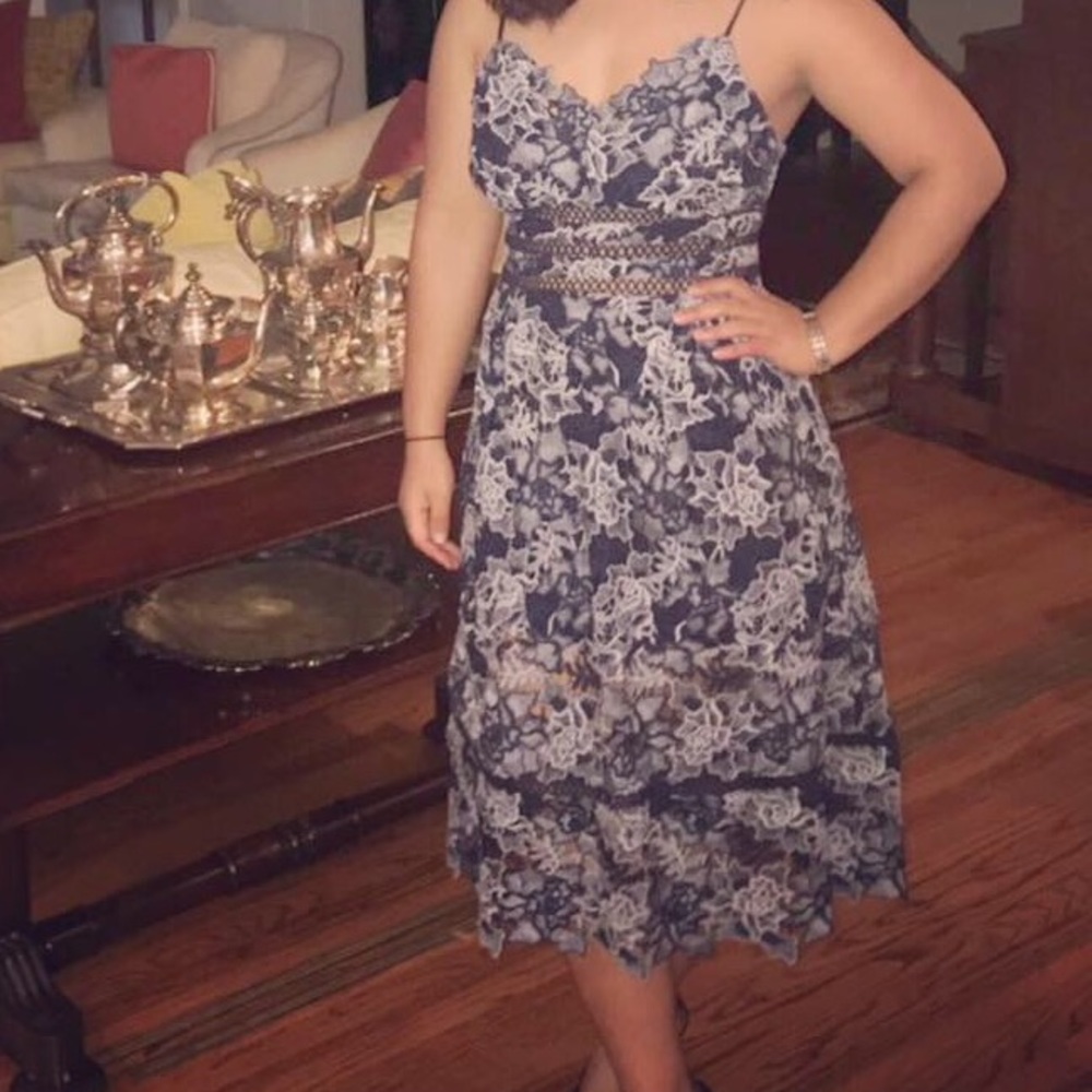 Mid length lace dress